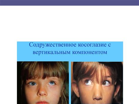 Воздействие эмоционального состояния на истолкование образов косоглазия в сновидении