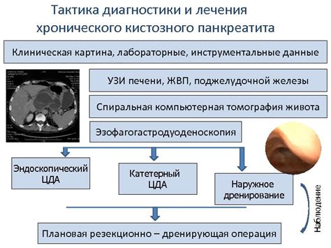 Возможности лечения кистозного расширения