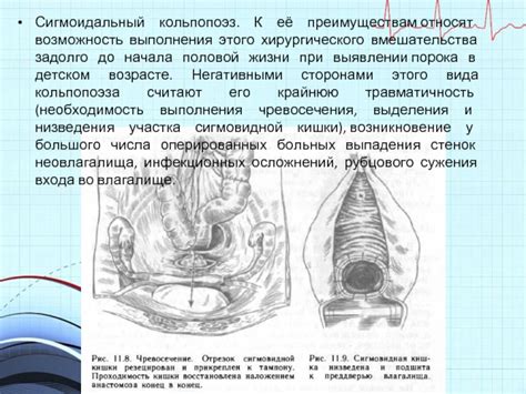 Возможность хирургического вмешательства