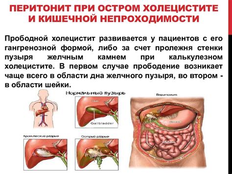 Возможные заболевания, приводящие к дрожи