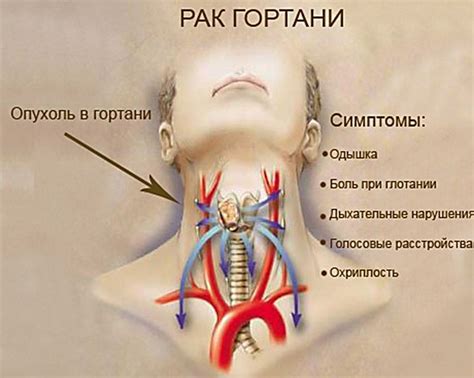 Возможные заболевания шеи