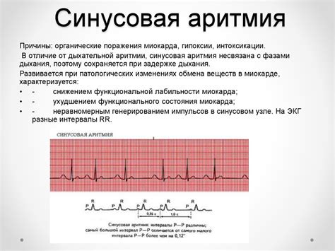 Возможные осложнения от низкого ритма сердца