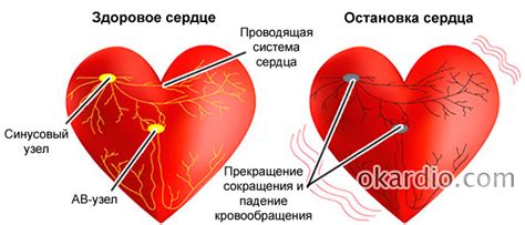 Возможные осложнения трепетного сердца