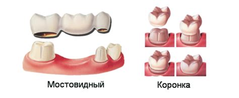 Возможные последствия отсутствия зуба