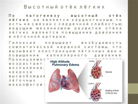 Возможные последствия пониженного атмосферного давления для нервной системы