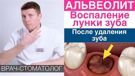 Возможные последствия после удаления сверхкомплектного зуба