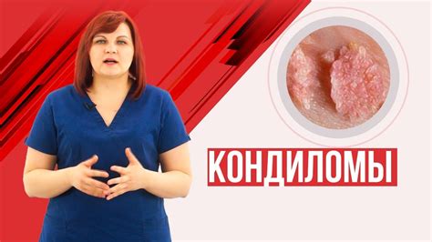 Возможные последствия удаления кондилом