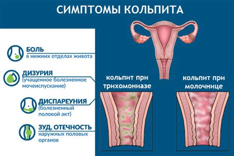 Возможные причины выделений у девушки