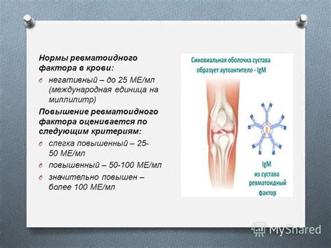 Возможные причины высоких значений ревматоидного фактора 600 мед мл: