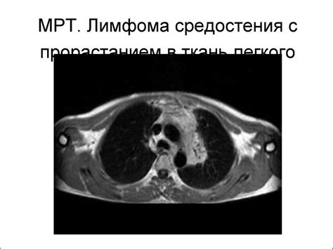 Возможные причины лимфаденопатии: