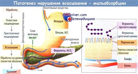 Возможные причины нарушения всасывания глюкозы и галактозы