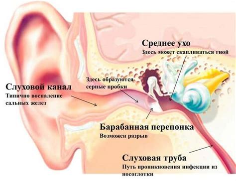 Возможные причины перфорирования барабанной перепонки