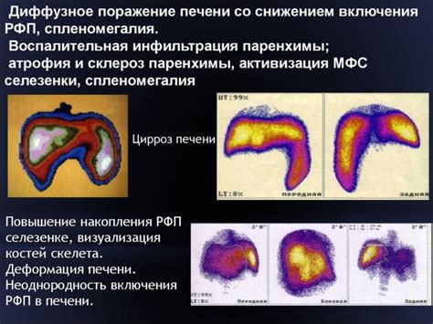 Возможные причины повышенной эхогенности паренхимы мозга