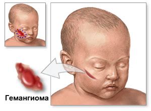 Возможные причины появления пунцовых щек