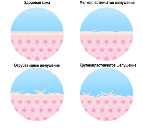 Возможные причины шелушения родинки