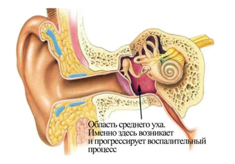 Воспаление среднего уха: симптомы и лечение