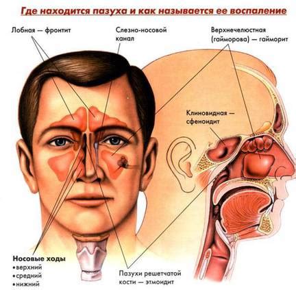 Воспалительные процессы в носу