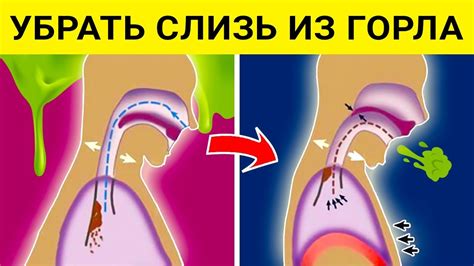 Вредные последствия задержки мокроты в организме