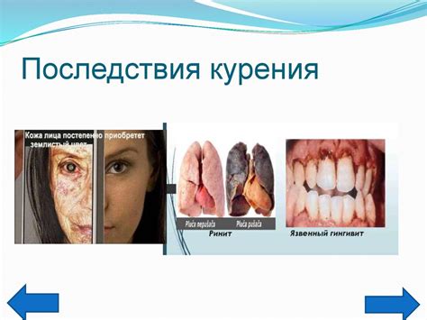 Вредные последствия потери лица