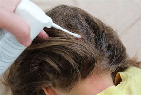 Вред SLS для волос и кожи головы