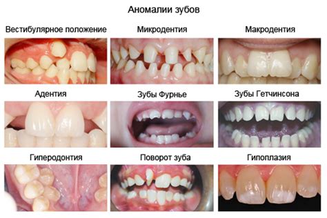 Врожденные аномалии: последствия удаления атипичного зуба