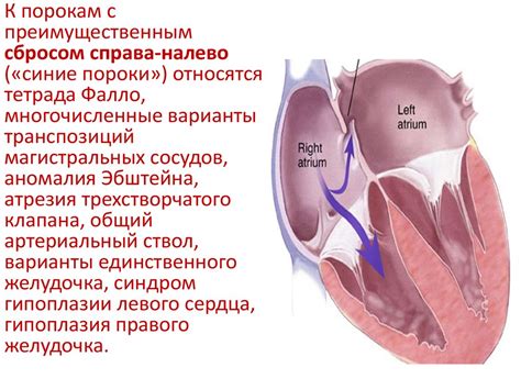 Врожденные причины шума сердца у взрослого