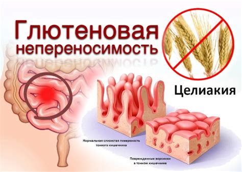 Все о коках: причины, симптомы и лечение