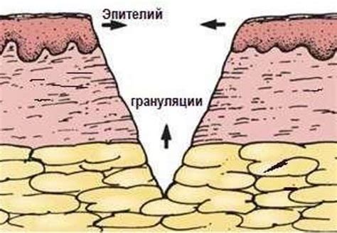 Вторичное натяжение шва: общая информация