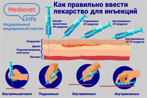 Выбор места для инъекции