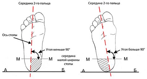 Выворот стопы: определение и основные понятия