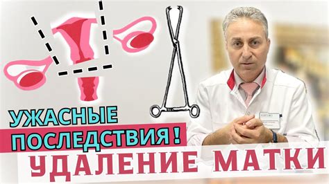 Вырывание матки: последствия и процесс удаления