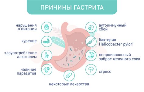 Гастрит: виды, причины и симптомы