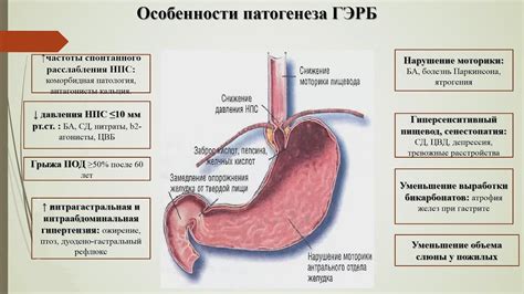 Гастроэзофагеальный рефлюкс