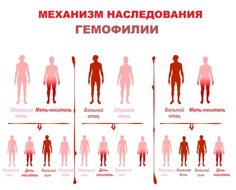 Гемофилия: главные симптомы и способы диагностики