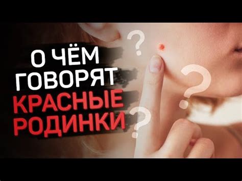 Генетические причины появления новой родинки