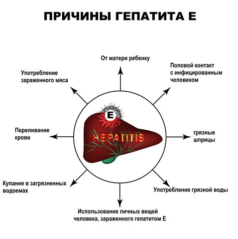 Гепатит А: симптомы, причины, диагностика