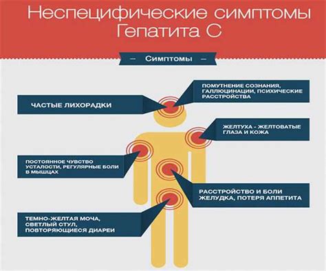 Гепатит положительный: симптомы и признаки