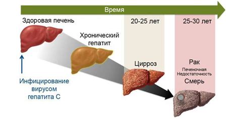 Гепатит C: что это и как его выявить