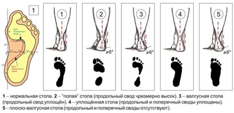 Гибкость и приспособляемость к форме стопы