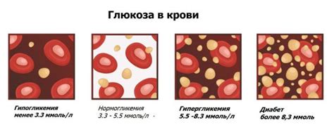 Гипогликемия: влияние на уровень глюкозы в моче