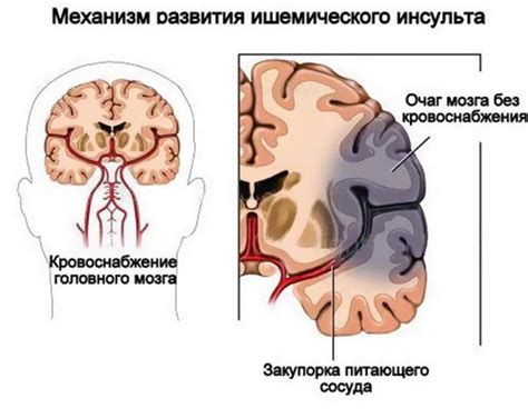 Гипоксия головного мозга у детей: причины, симптомы, лечение