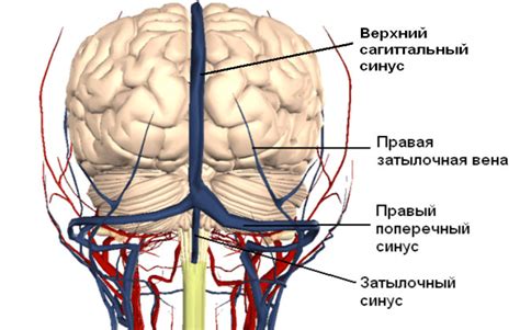 Гипоплазия левого поперечного синуса головного мозга