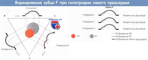 Глава 1: Что такое ЭКГ-признаки ГЛП