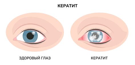 Глазные проблемы