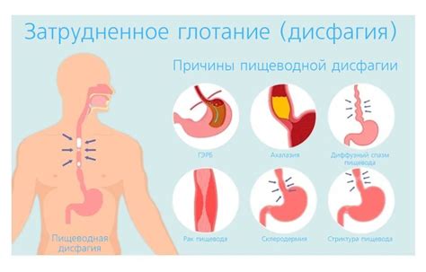 Глотание пищи и дискомфорт: что делать?