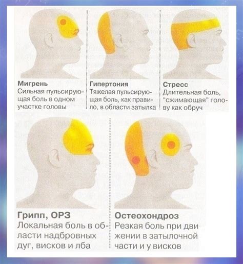 Головная боль и изменение погоды: как справиться с неприятным состоянием?