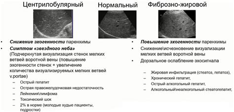 Гомогенная эхоструктура печени: основные характеристики