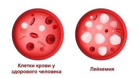 Гормональные причины появления крупных кусков крови