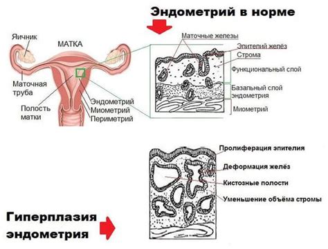 Гравидарная трансформация эндометрия: определение и сущность