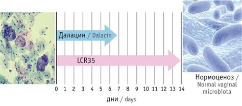 Грамвариабельные коккобациллы: какая роль у них в организме женщин?